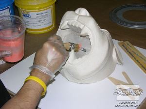 לחיצה להגדלת תמונה מודדים, מערבבים ומורחים שכבה ראשונה (דקה) של סיליקון למריחה Rebound® 25 על המודל. יחס הערבוב של החומר הוא 1:1 לפי נפח.