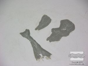 לחיצה להגדלת תמונה מעצבים את הצלקות כך שילכו ויהיו דקות באזור הדפנות