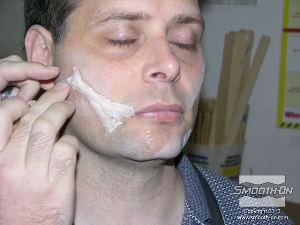 לחיצה להגדלת תמונה לאחר שהסיליקון נעשה טאקי (דביק) מניחים את הצלקת הראשונה במקומה.