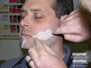 לחיצה להגדלת תמונה ממקמים גם את הצלקת האחרונה.