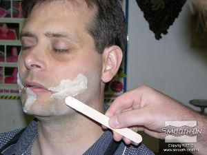 לחיצה להגדלת תמונה מערבבים עוד קצת סיליקן Skin Tite ומורחים על הצלקות כדי להחליק את קצוות הצלקות.