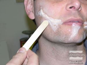 לחיצה להגדלת תמונה חוזרים על טכניקה זו (של החלקת הקצוות) על כל הצלקות.