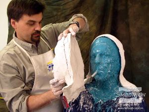 לחיצה להגדלת תמונה לאחר התמצקות התחבושות ניתן להוריד את מעיל התמיכה.